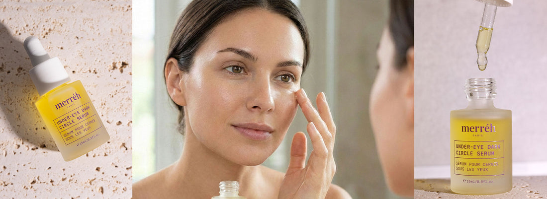 Как да елиминираме тъмните кръгове под очите?